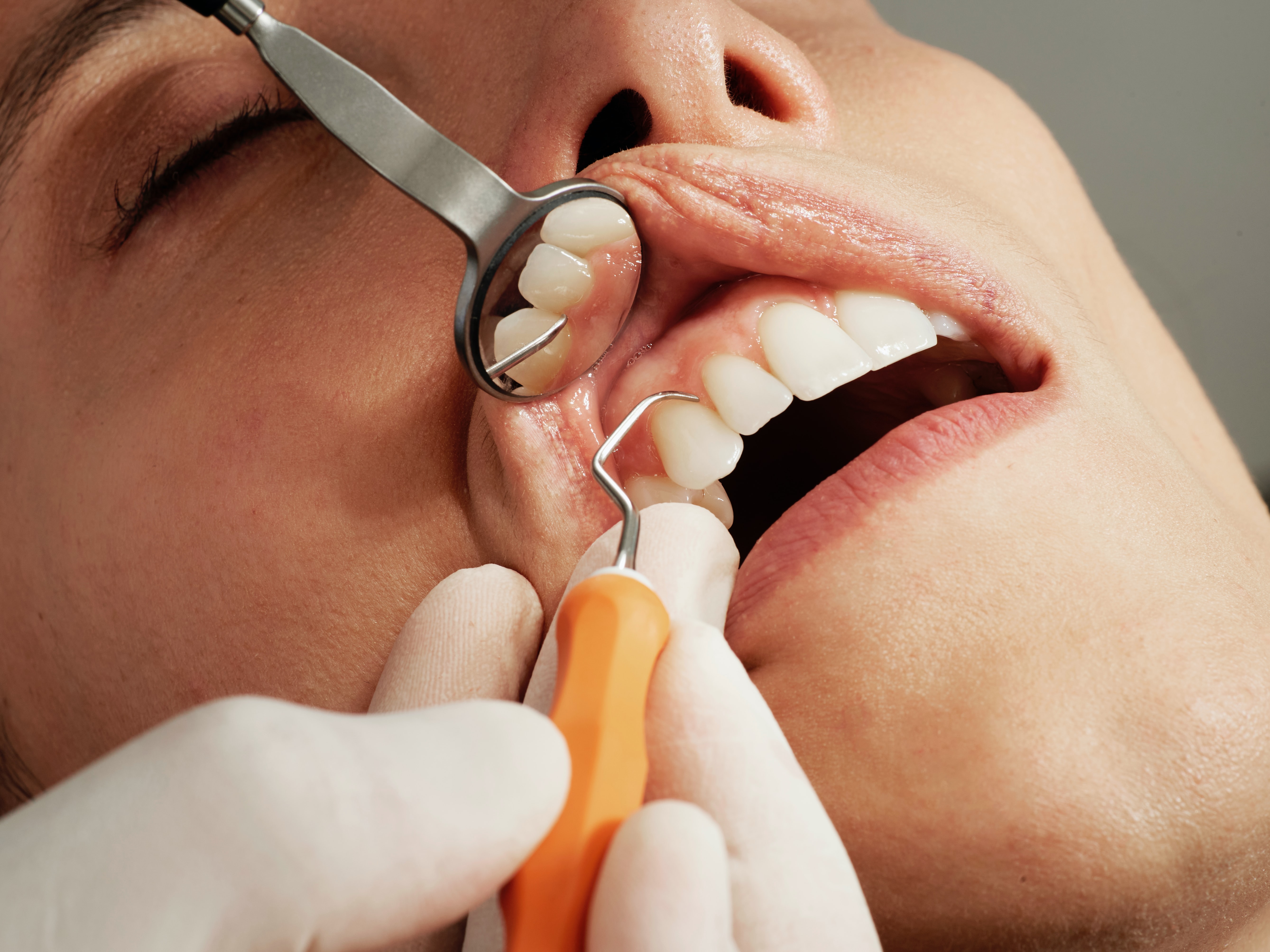 dental dentist teeth